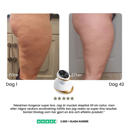 CelluSmooth™ - Massageapparat
